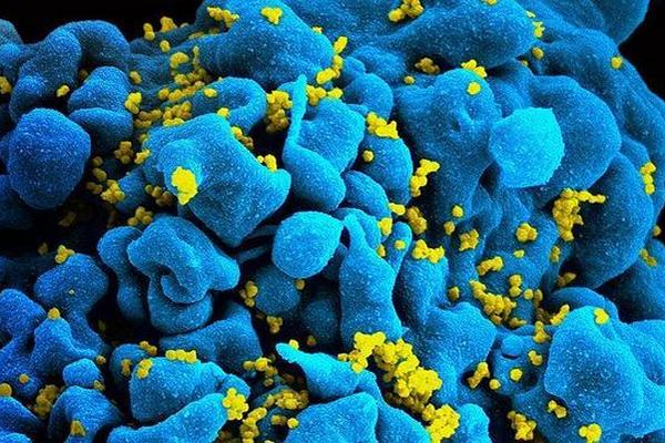 Terapia desactiva virus del sida y otros virus de transmisión sexual