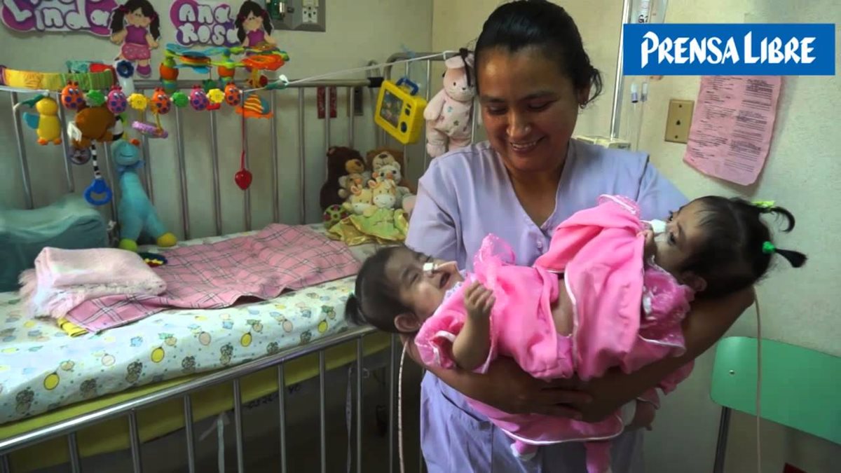 Las siamesas Rosa Linda y Ana Rosa cumplieron un año en el Hosital Roosevelt. (Foto Prensa Libre: Hemeroteca PL)