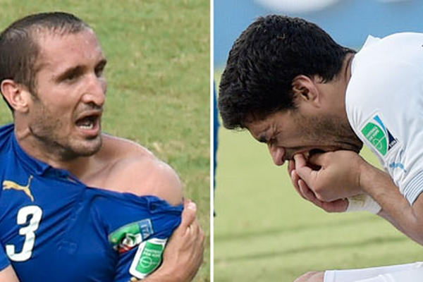 El futbolista italiano Giorgio Chiellini muestra la mordida que le dio el uruguayo Luis Suárez. (Foto Prensa Libre: AFP)