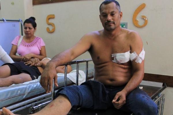 René Martínez Morales, concejal segundo de Pasaco, Jutiapa, permanece en el Hospital Nacional de Escuintla. (Foto Prensa Libre: Enrique Paredes)