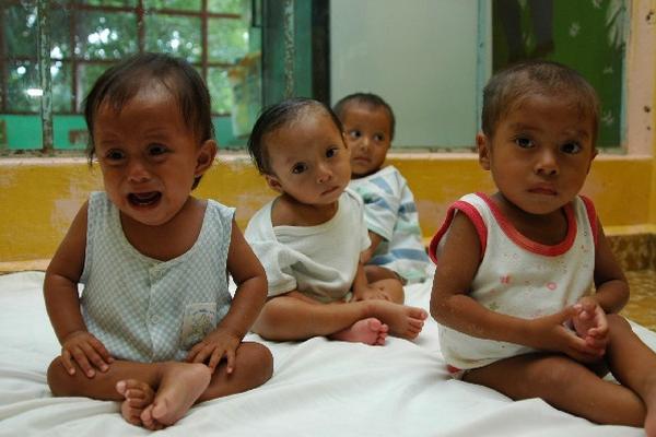 Con el protocolo aprobado se pretende tener elementos para salvar a niños con desnutrición.