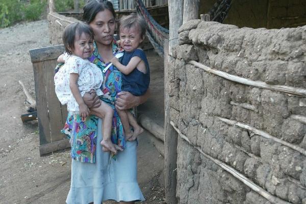 En 2014 58 niños han muerto a causa de desnutrición aguda en Guatemala. (Foto Prensa Libre: Archivo)<br _mce_bogus="1"/>