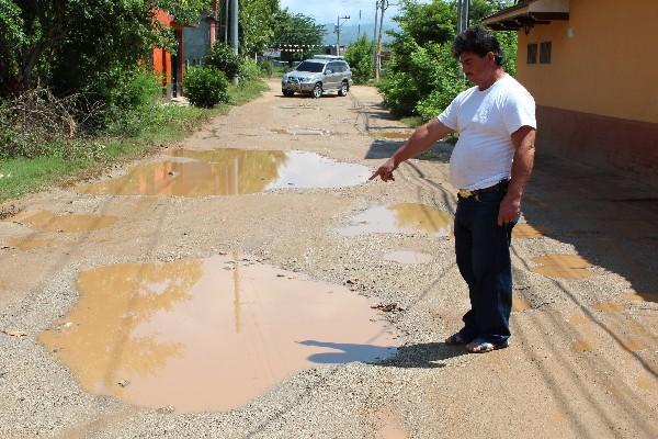 Vecino muestra los baches llenos de agua.