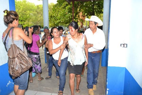 Una de las heridas en el percance vial es ingresada al Hospital Regional de Zacapa. (Foto Prensa Libre: Víctor Gómez)<br _mce_bogus="1"/>