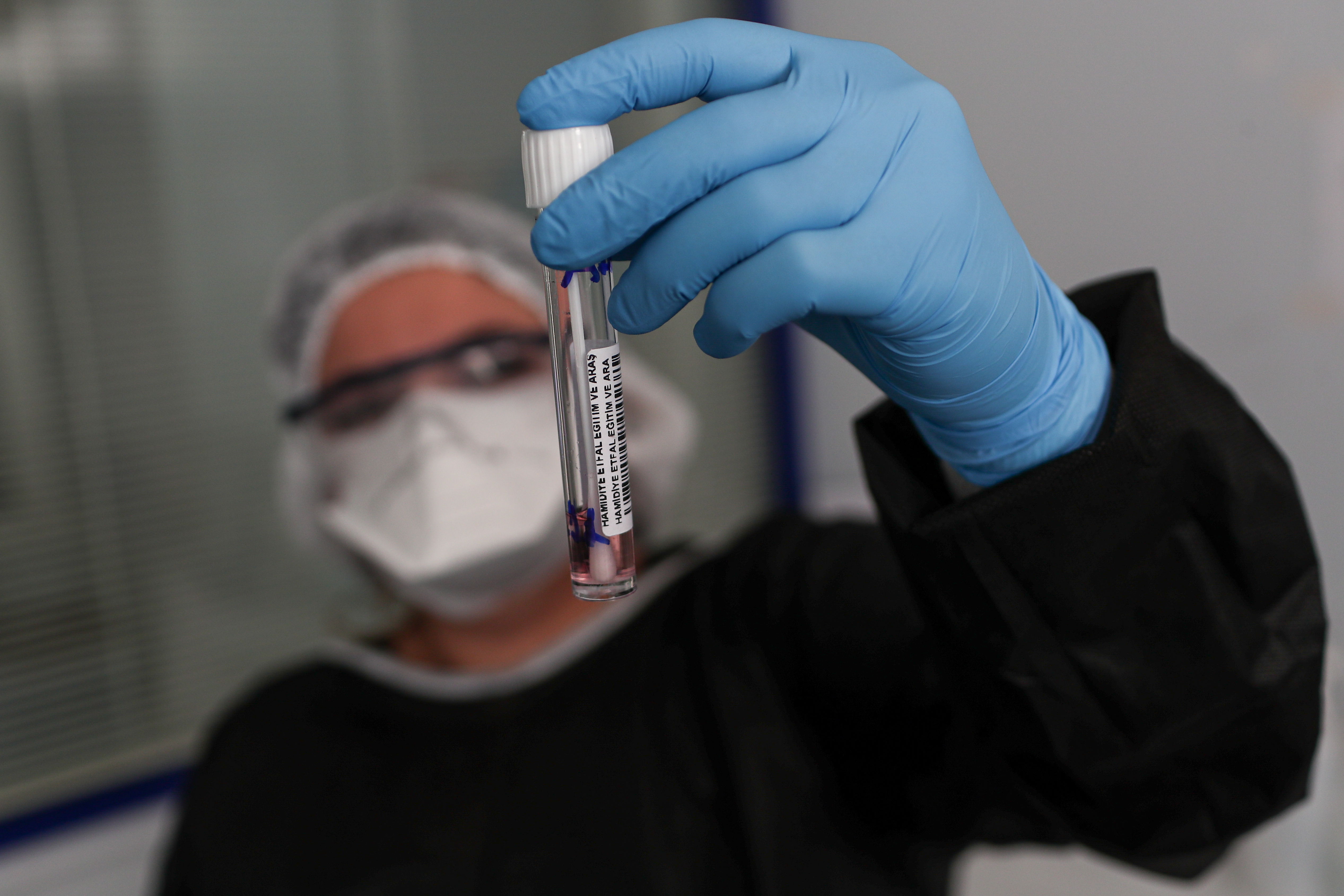 Istanbul (Turkey), 20/05/2020.- A health worker displays a vial containing a swab sample while conducting COVID-19 tests at the Istanbul Sisli Hamidiye Etfal Training and Research Hospital, in Istanbul, Turkey, 20 May 2020 (issued 22 May 2020). President Erdogan announced a curfew in 81 Turkish cities, including Istanbul, from 23 to 26 May 2020 to curb the spread of the coronavirus disease (COVID-19) pandemic. The lockdown coincides with the festival of Eid al-Fitr, which marks the end of the Muslim fasting month of Ramadan. (Turquía, Estanbul) EFE/EPA/SEDAT SUNA