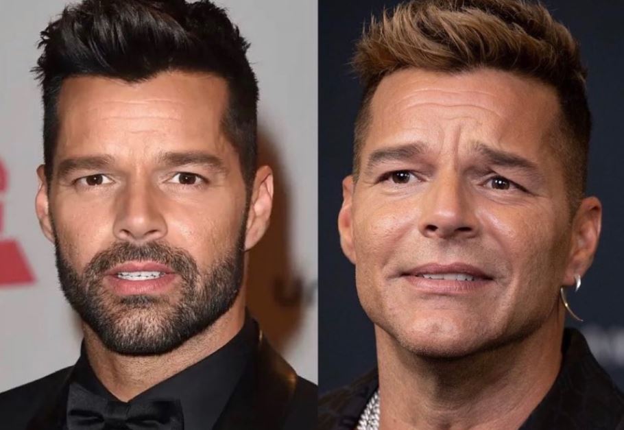 Se Hizo Un Retoque Est Tico Ricky Martin Revolucion Las Redes   Ricky Martin 