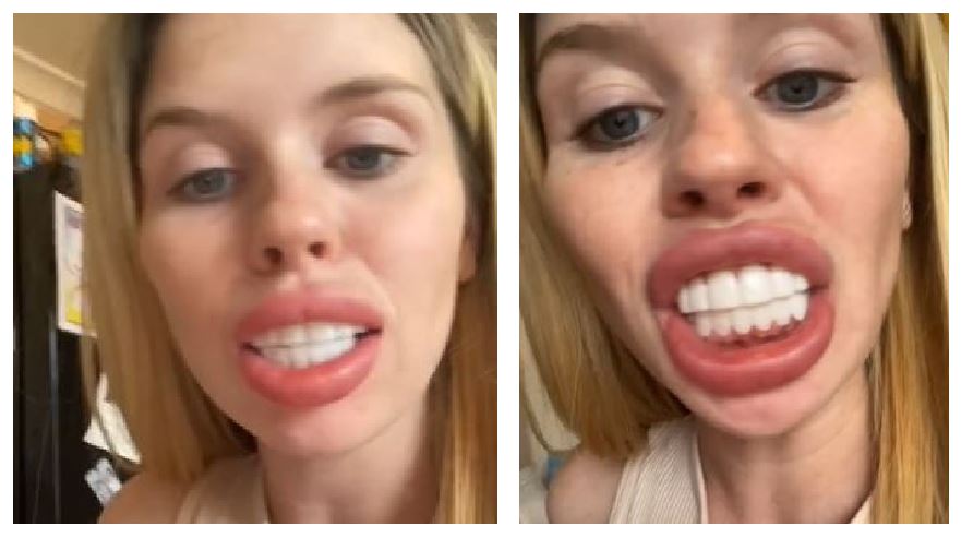 mujer con dentadura