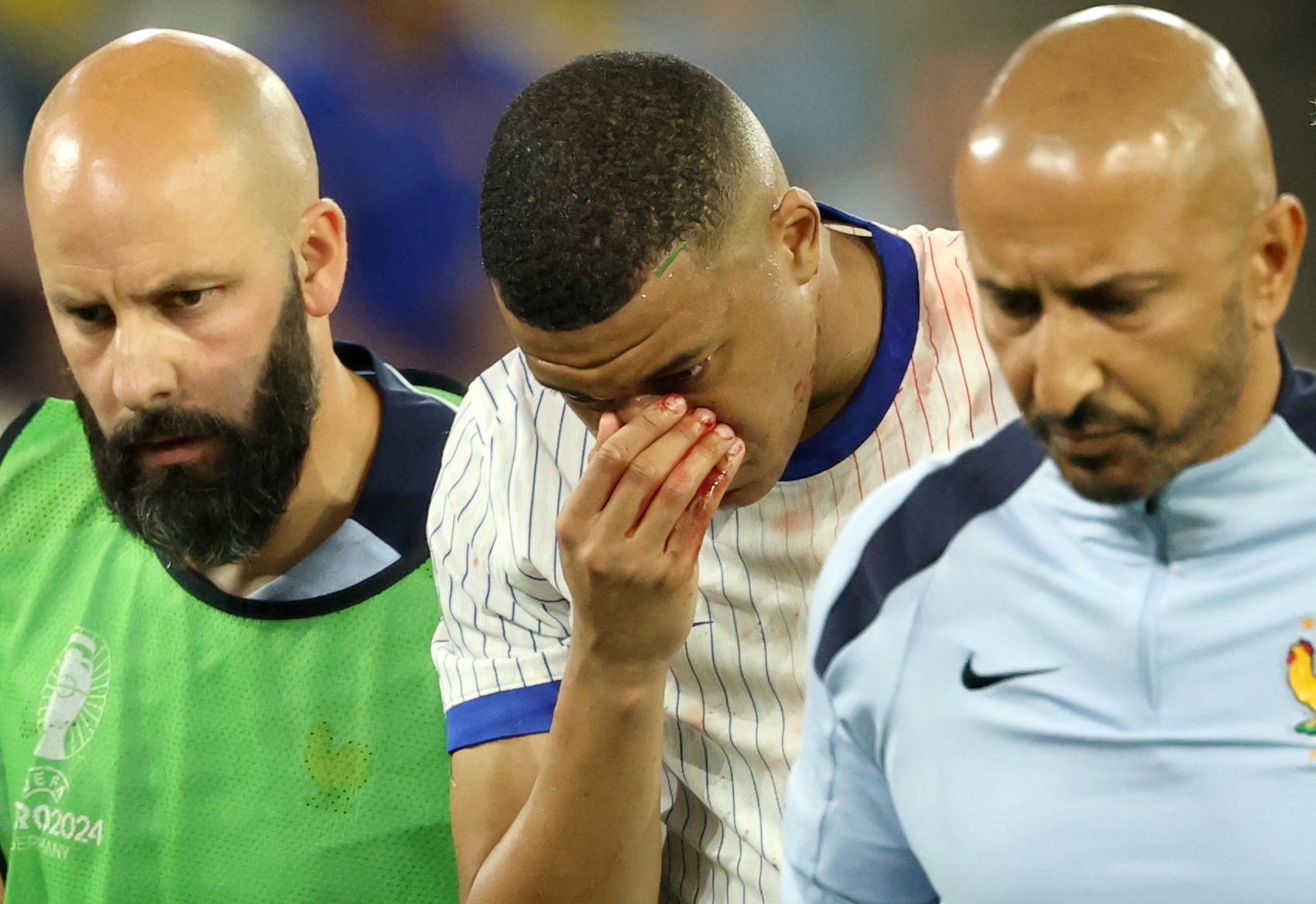 Kylian Mbappé saliendo del terreno de juego después del golpe.