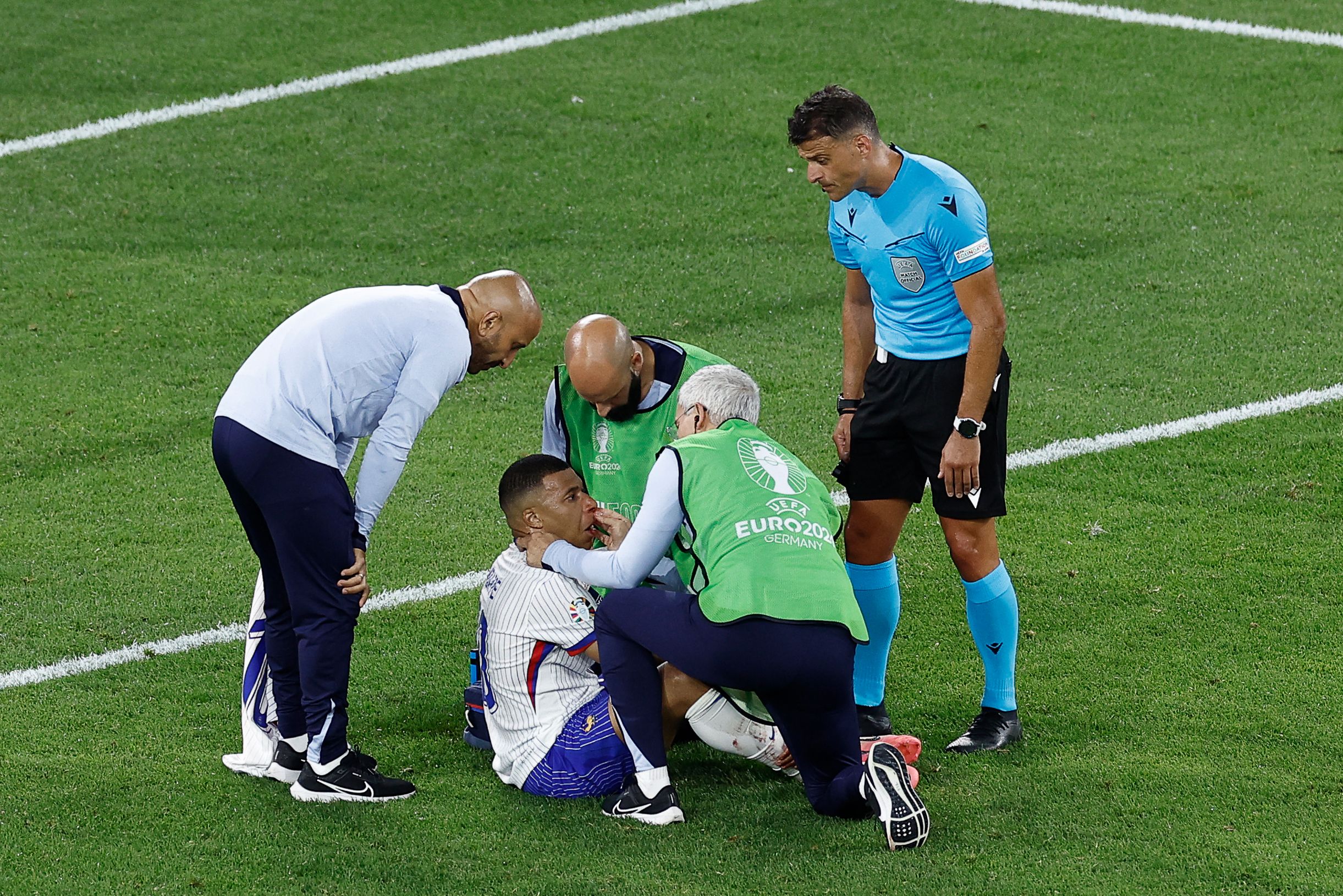 Después de someterse a los exámenes médicos, Mbappé regresó a la concentración de la Selección de Francia, después de sufrir una fractura en la nariz. (Foto Prensa Libre: AFP).