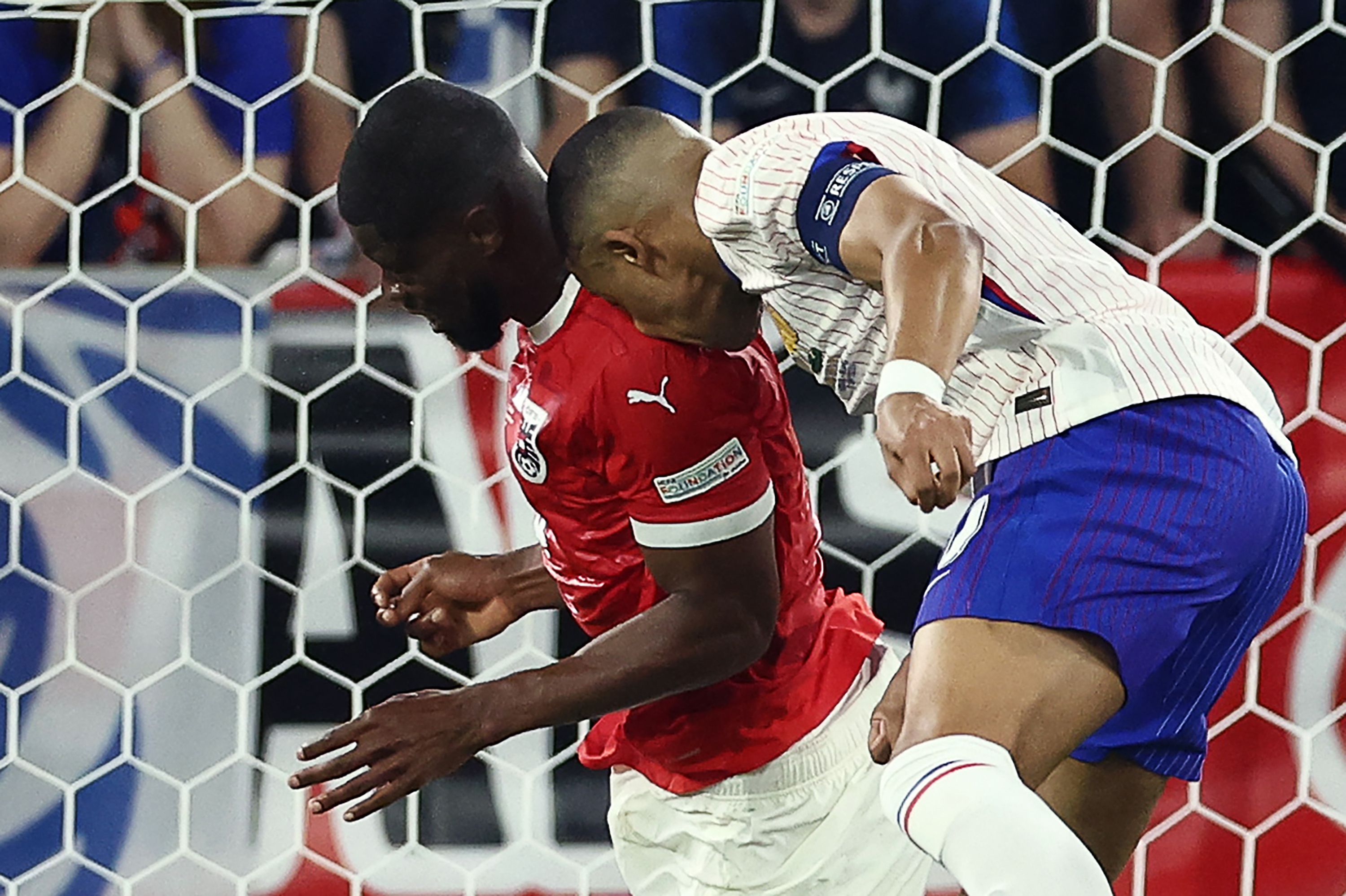 Kylian Mbappé genera preocupación en Francia tras su lesión.