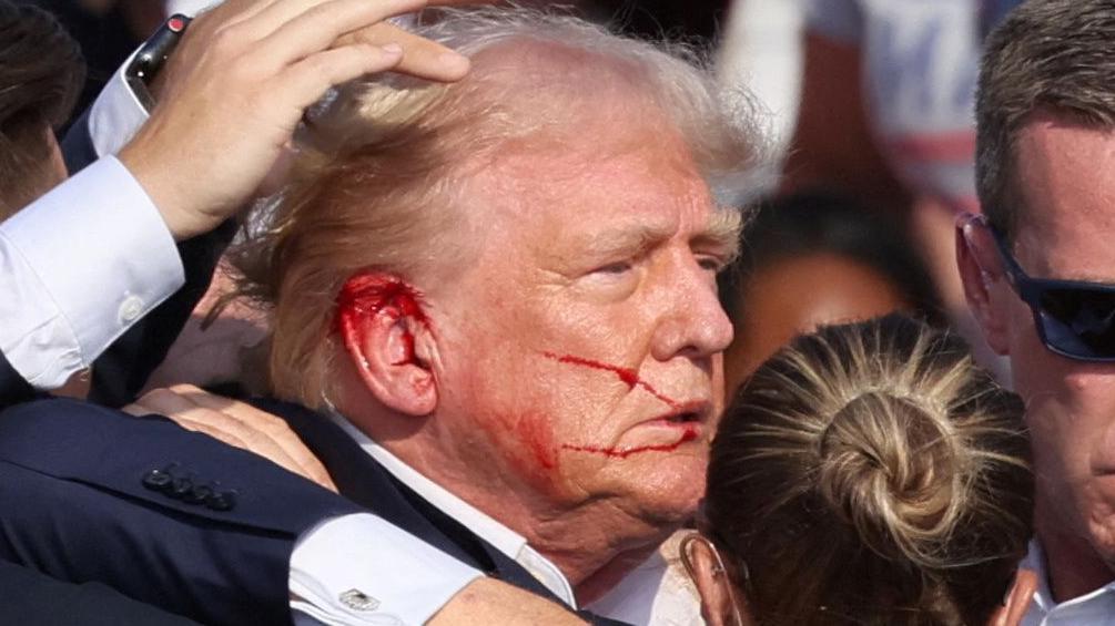 Donald Trump fue rozado por una bala en la parte superior de su oreja derecha.
Reuters