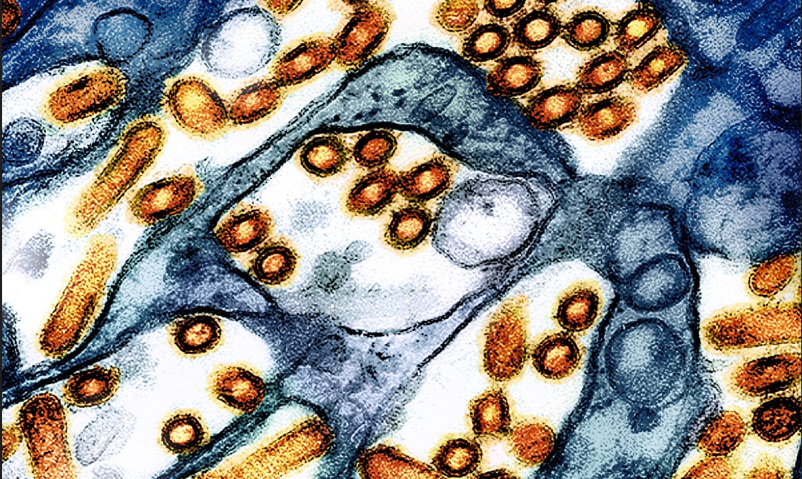 Una imagen de influenza aviar que creció en un cultivo celular obtenida con microscopio electrónico, con colores asignados. (Foto Prensa Libre: CDC/NIAID vía The New York Times)