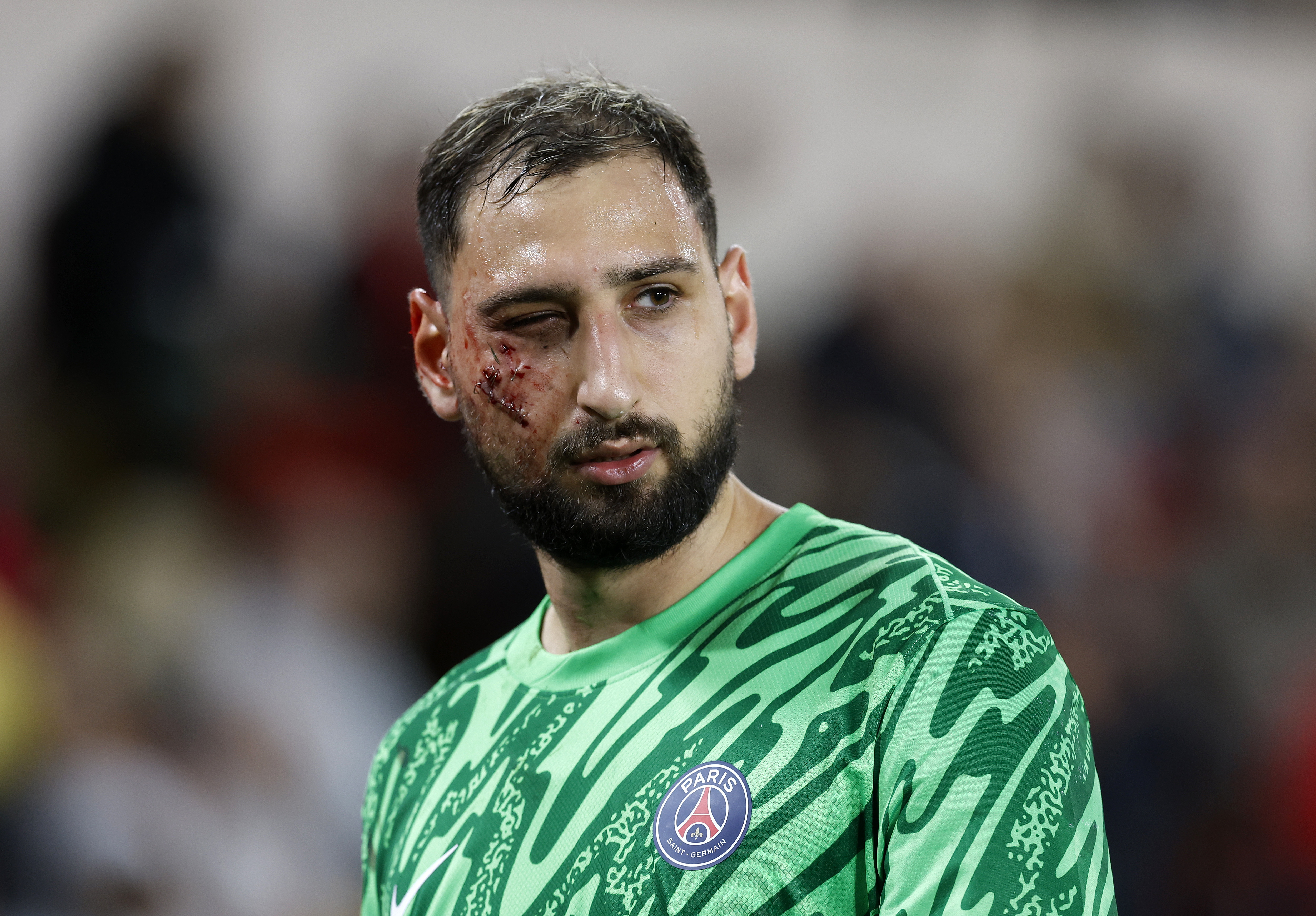 Gianluigi Donnarumma no pudo continuar en el partido luego de sufrir una lesión.