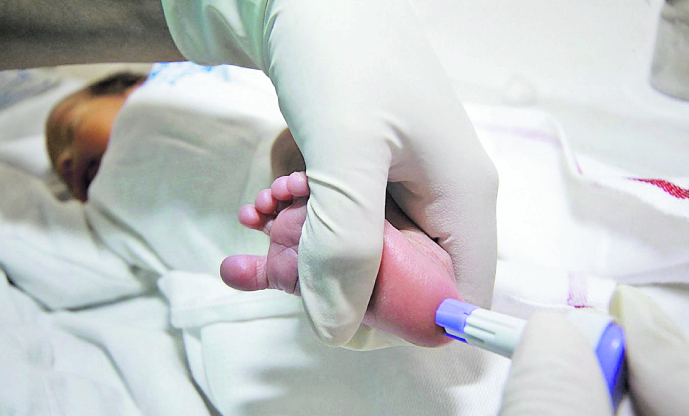 TAMIZAJE NEONATAL